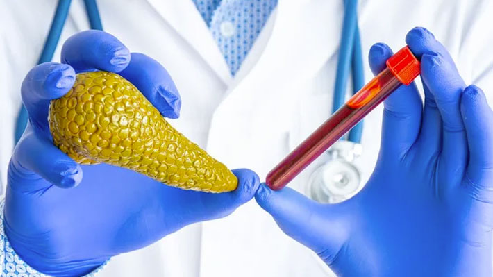 Stylised human pancreas in a doctor's (gloved) right hand and test tube with blood sample in it - in gloved left hand